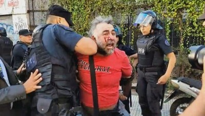 La Policía hirió y detuvo a un camarógrafo de A24 frente al Congreso