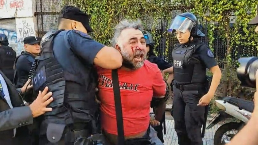 La Policía hirió y detuvo a un camarógrafo de A24 frente al Congreso